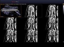 Плод, скелет, Multi OVIX, режим прозрачности X-ray, 3D