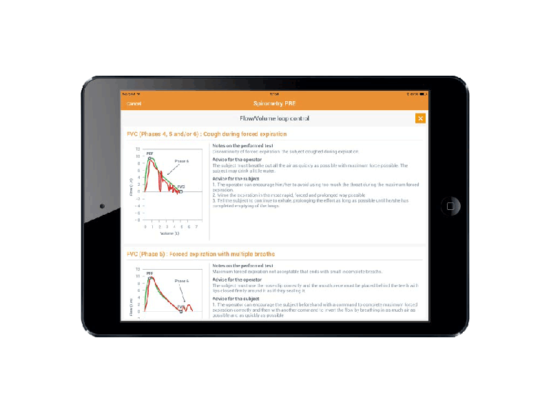 Спирометр для IPAD SPIROBANK II SMART с опцией оксиметрии