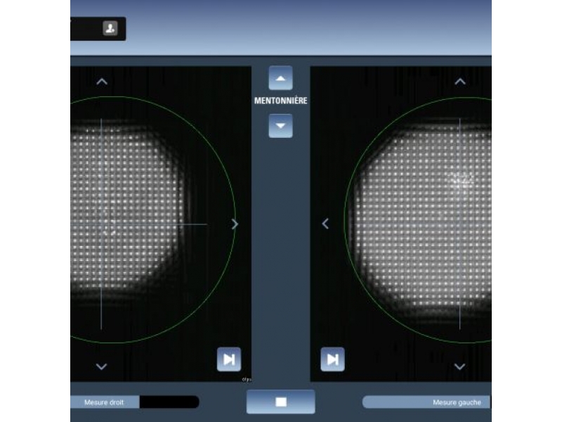 Автоматическая система для аберрометрии EyeRefract