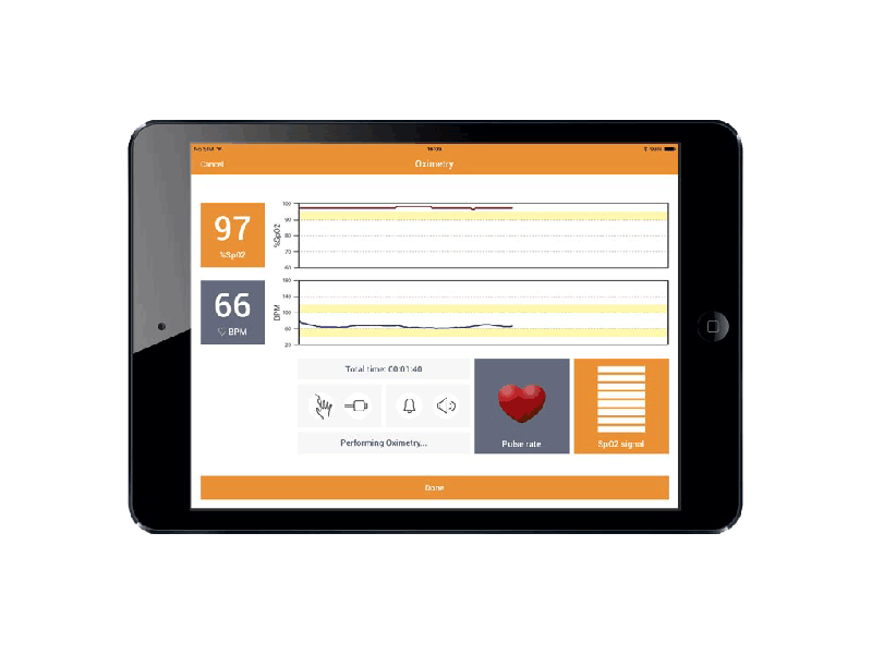 Спирометр для IPAD SPIROBANK II SMART с опцией оксиметрии