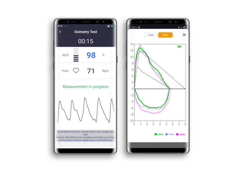 Спирометр портативный SPIROBANK SMART