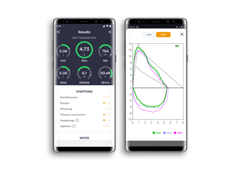 Спирометр портативный SPIROBANK SMART