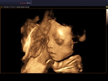 Плод, лицо, 3D