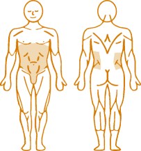 Мышцы, нагружаемые пневматическим тренажером для спины Abdominal Enraf Nonius Мышцы, нагружаемые пневматическим тренажером для спины Abdominal Enraf Nonius