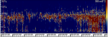Пример сжатого спектра с доминирующим альфа-ритмом