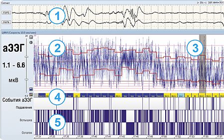 Отображение данных на мониторе церебральных функций «Энцефалан-ЦФМ». Вариант «Профессиональный»