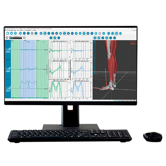 Динамометрическая платформа 3D комплекс Биокинект