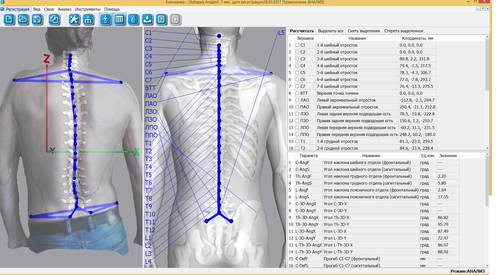 Бодисканер 3D БИОКИНЕКТ