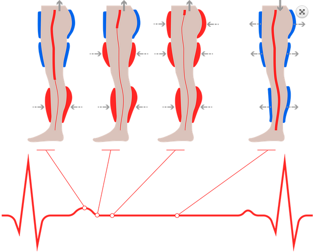 Аппарат усиленной наружной контрпульсации P-ECP/TI Аппарат усиленной наружной контрпульсации P-ECP/TI