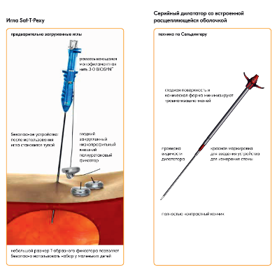 Набор интродукторов для гастростомической питательной трубки AVANOS* MIC* и MIC-KEY**
