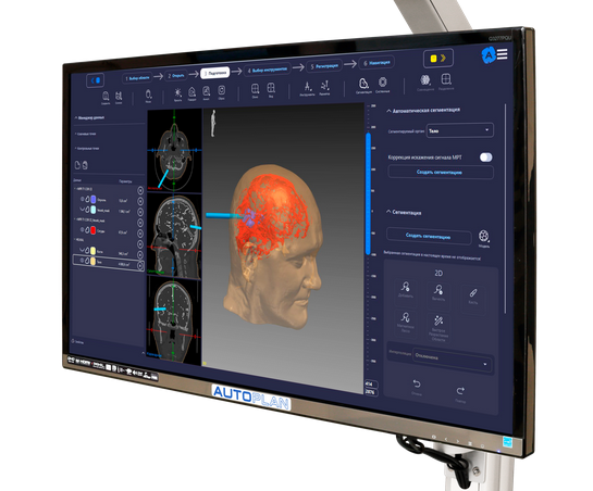 Хирургическая навигация AUTOPLAN Хирургическая навигация AUTOPLAN