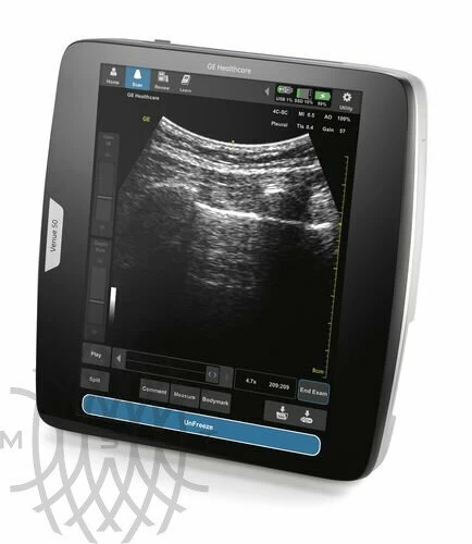 Аппарат УЗИ GE Venue 50 Аппарат УЗИ GE Venue 50