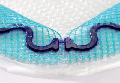 Композитный вентральный пластырь Parietex™ (PCO)