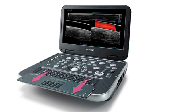 Портативная ультрозвуковая система E-CUBE i7  Портативная ультрозвуковая система E-CUBE i7