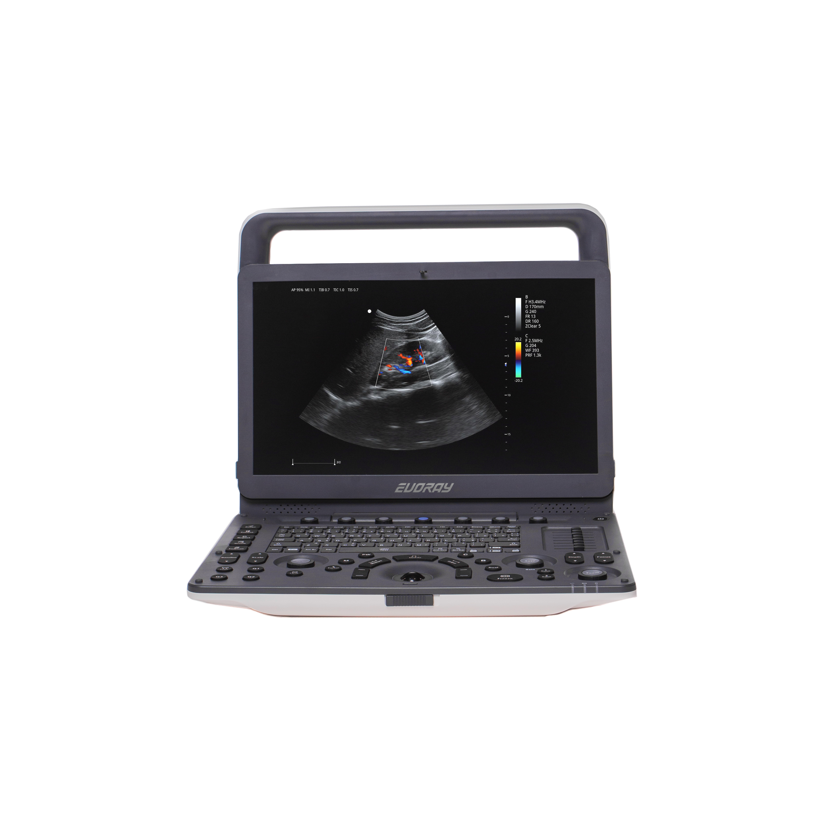 Портативный УЗИ аппарат  EVORAY USP 30