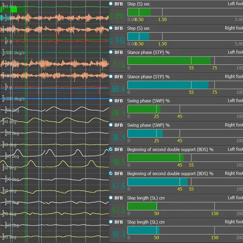 Тренажер ходьбы Биокинект