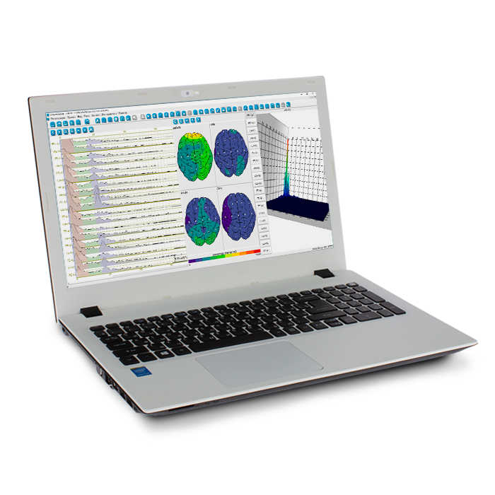 Электроэнцефалограф «Неврополиграф»