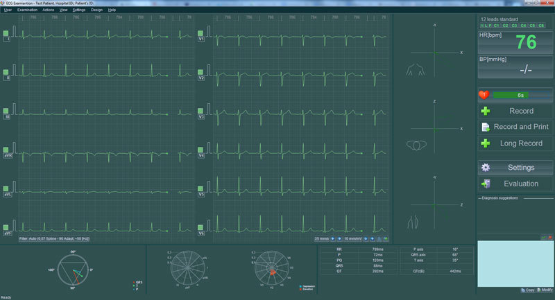 Беспроводная система ЭКГ BTL Cardiopoint Flexi Беспроводная система ЭКГ BTL Cardiopoint Flexi