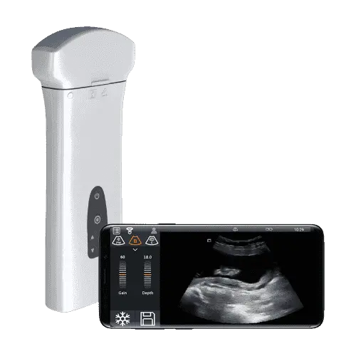 DELTA D8 портативная УЗ-система DELTA D8 портативная УЗ-система