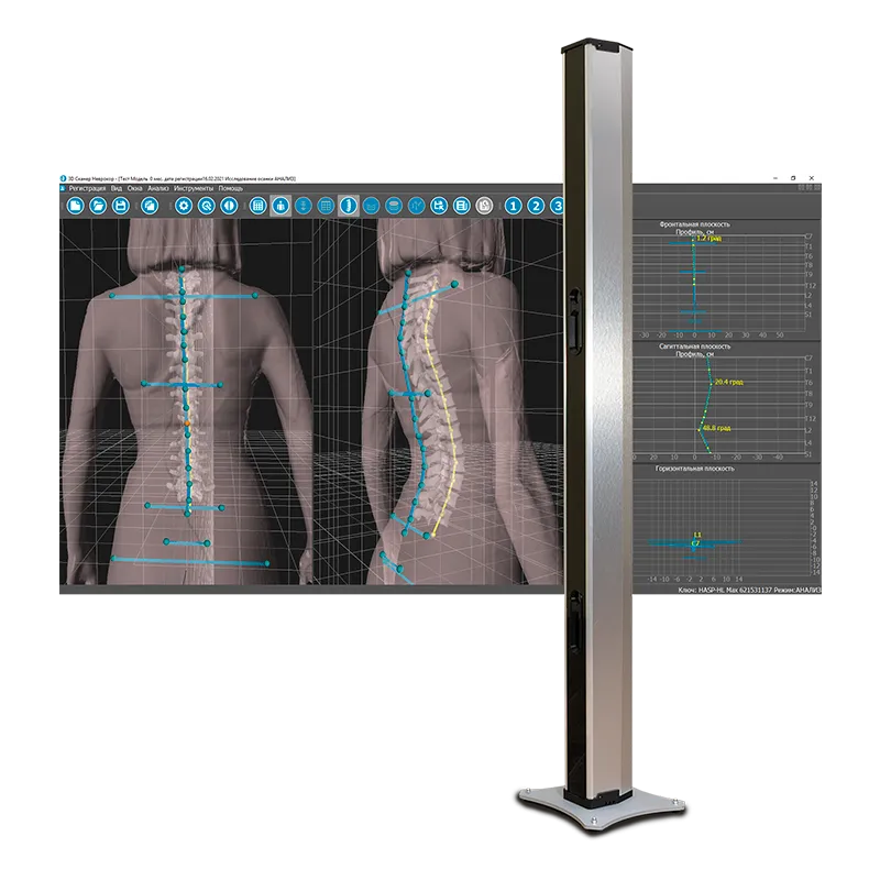 Бодисканер 3D БИОКИНЕКТ