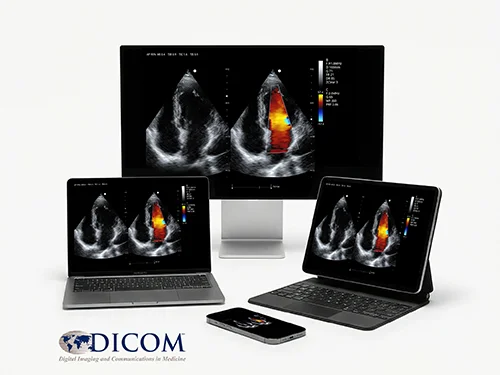 Ультразвуковая система  EVORAY USS 20