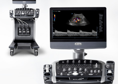 Ультразвуковая система E-CUBE 9 Ультразвуковая система E-CUBE 9