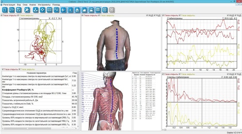 Бодисканер 3D БИОКИНЕКТ