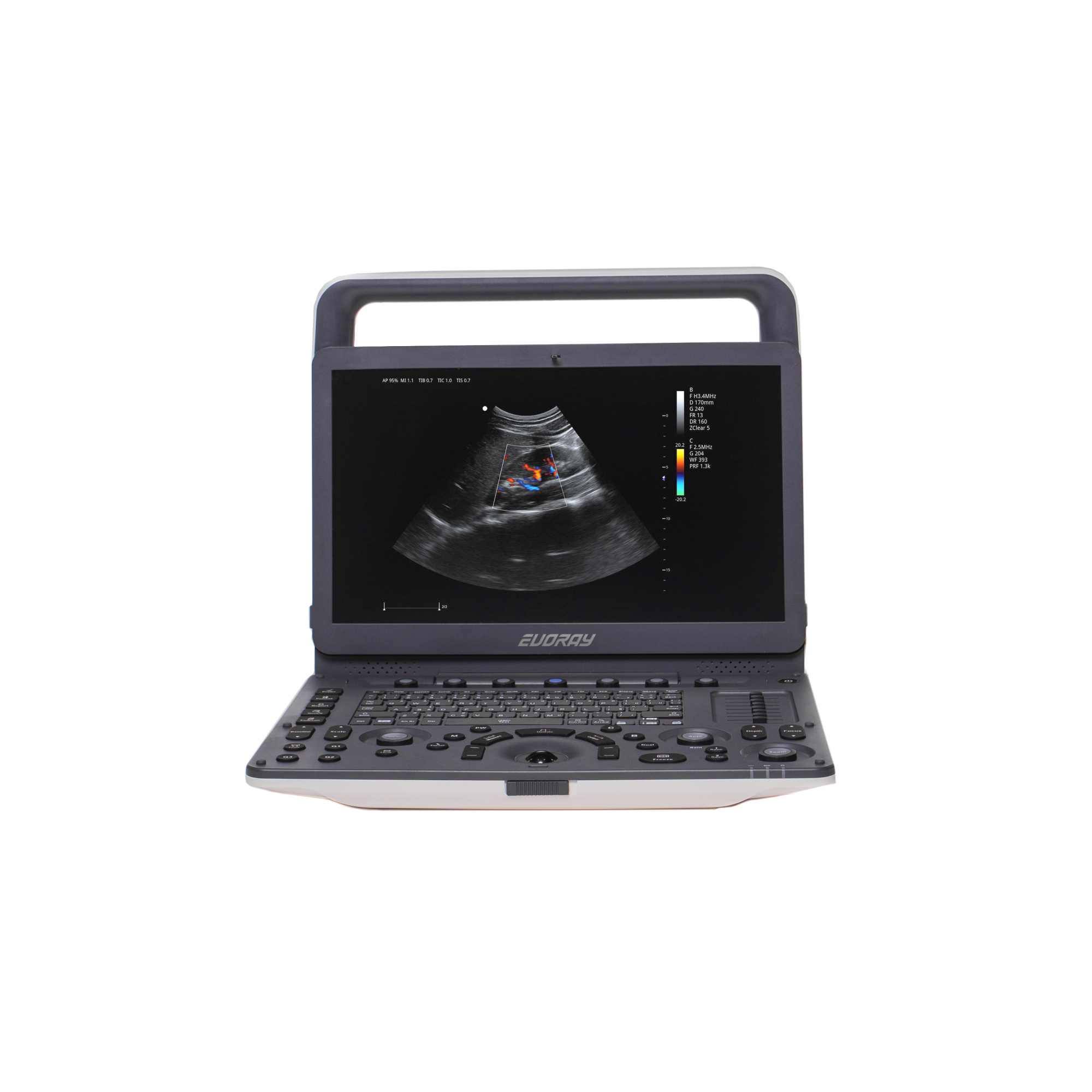 Портативный УЗИ аппарат  EVORAY USP 30