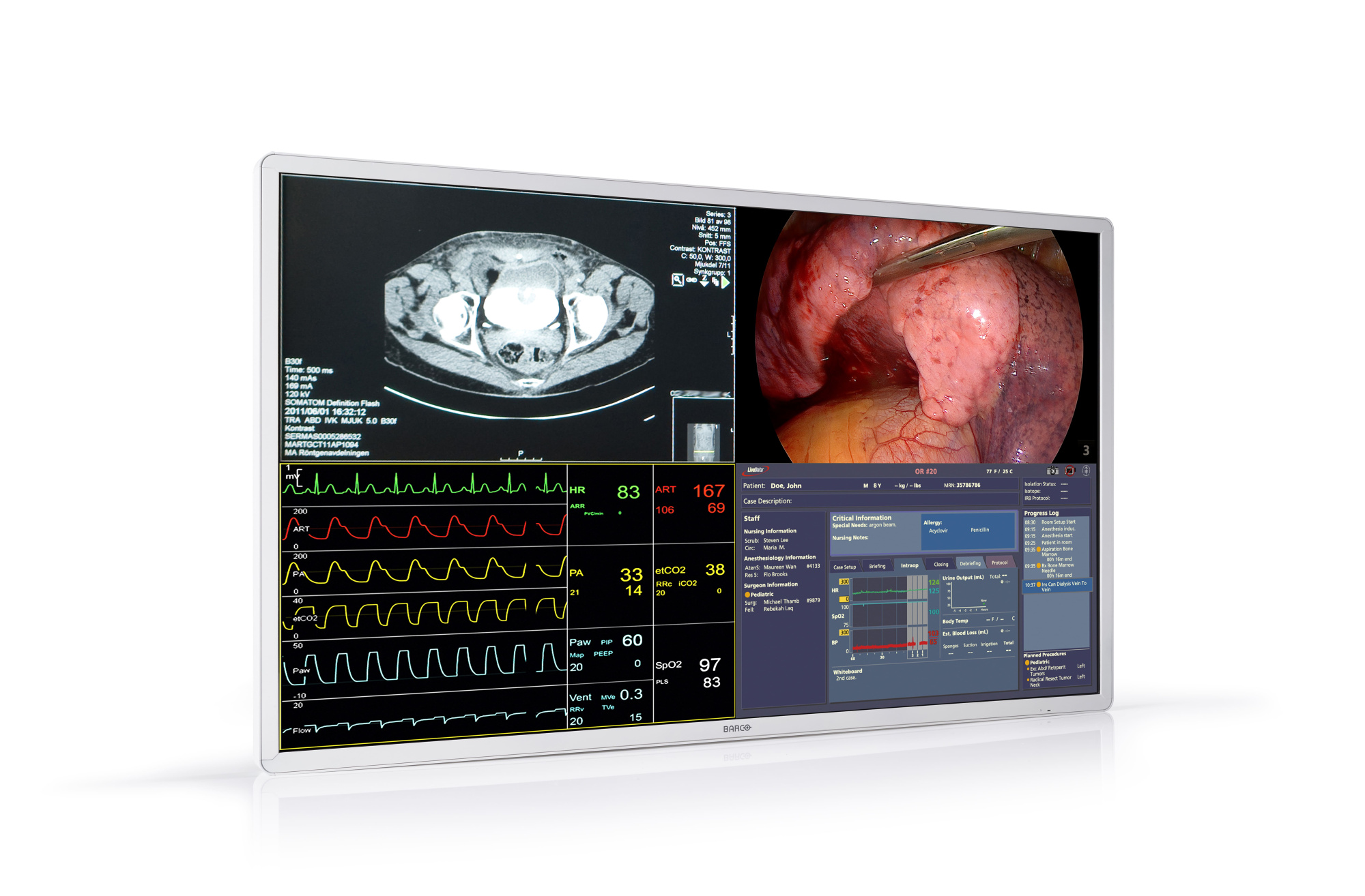 Монитор медицинский MDSC-8255 Монитор медицинский MDSC-8255