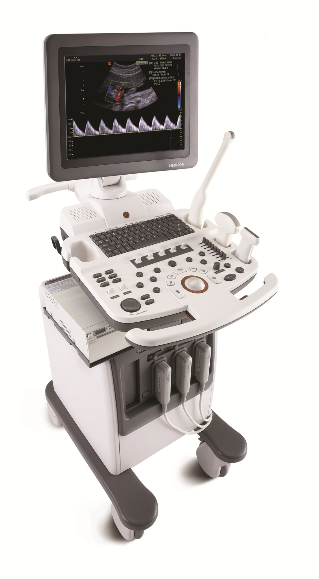 УЗИ сканер SonoAce R5 УЗИ сканер SonoAce R5