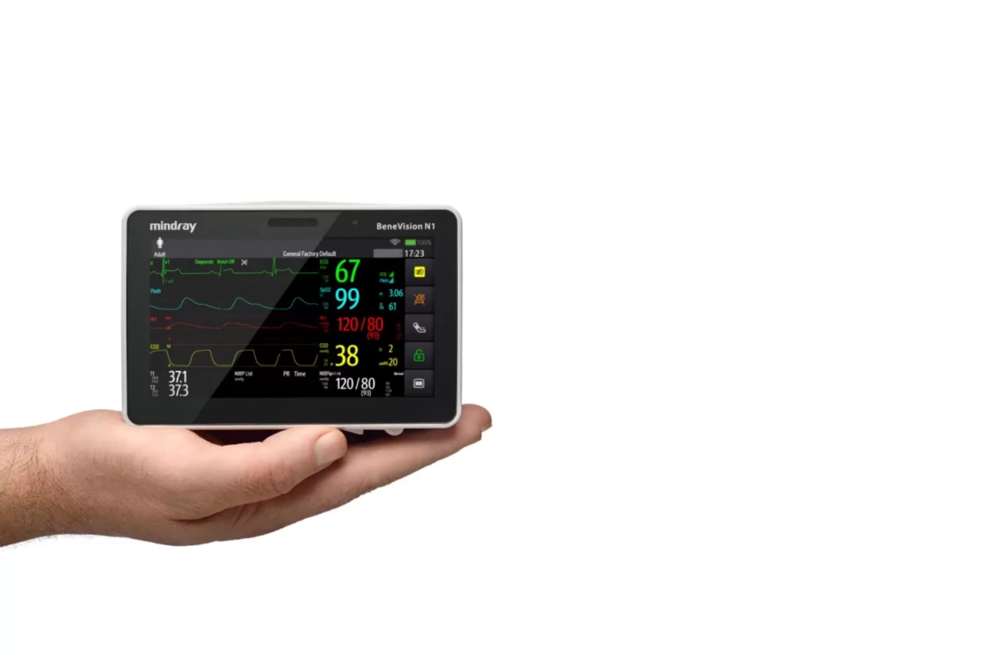 Монитор пациента Mindray BeneVision N1