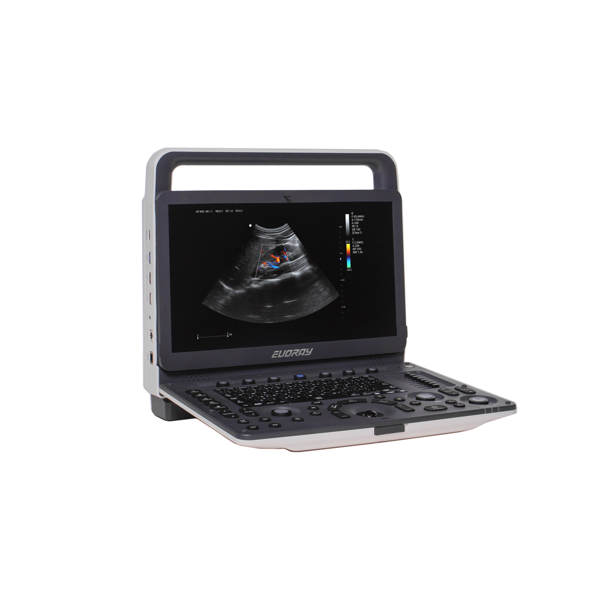 Портативный УЗИ аппарат  EVORAY USP 30