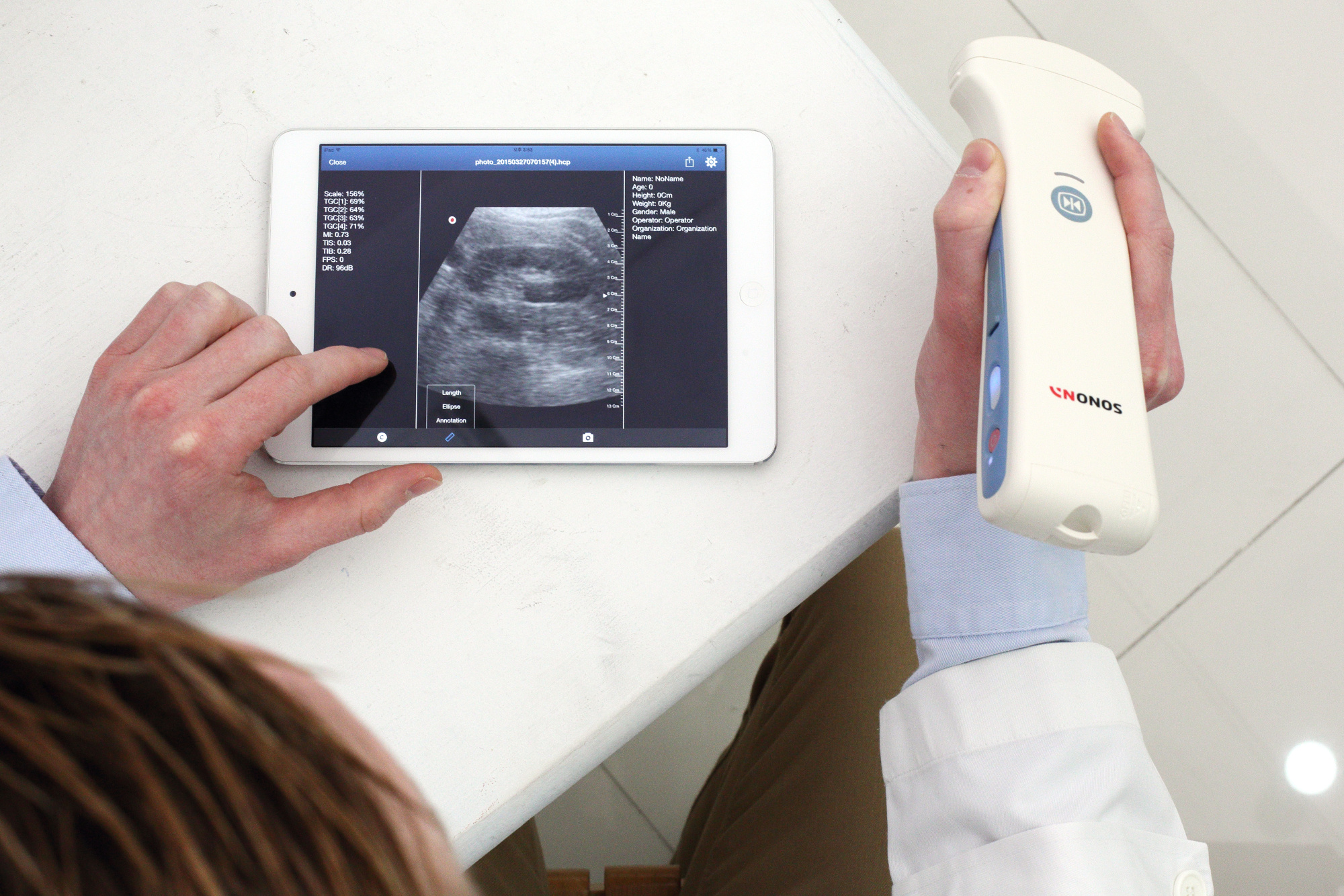 Портативный ультразвуковой сканер Sonon 300 C Портативный ультразвуковой сканер Sonon 300 C