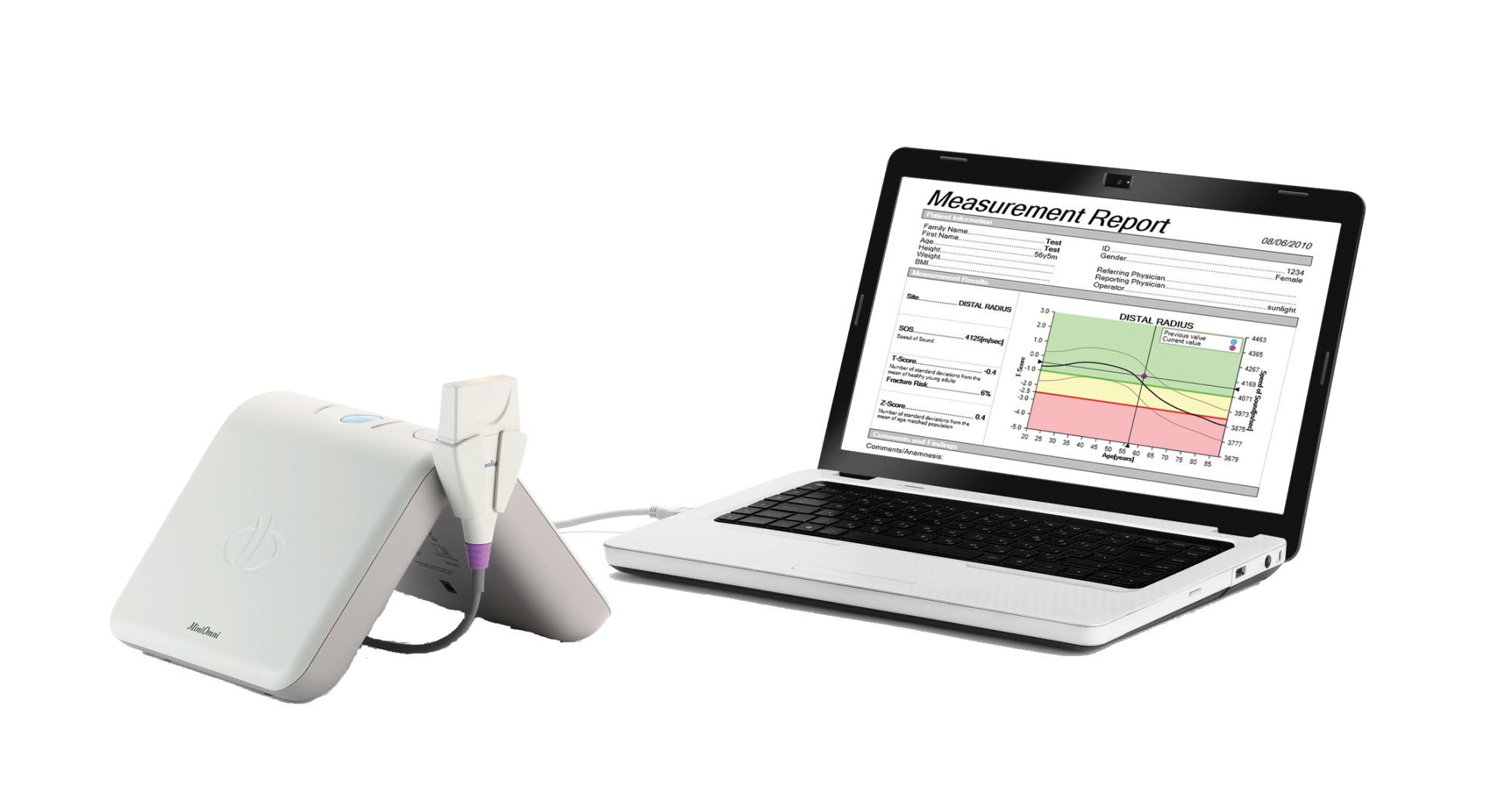 Ультразвуковой остеоденситометр MiniOmni